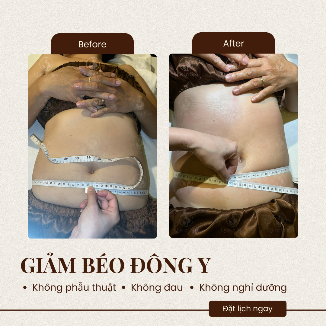 Hiệu quả liệu trình massage dưỡng sinh giảm béo tại Queen Spa