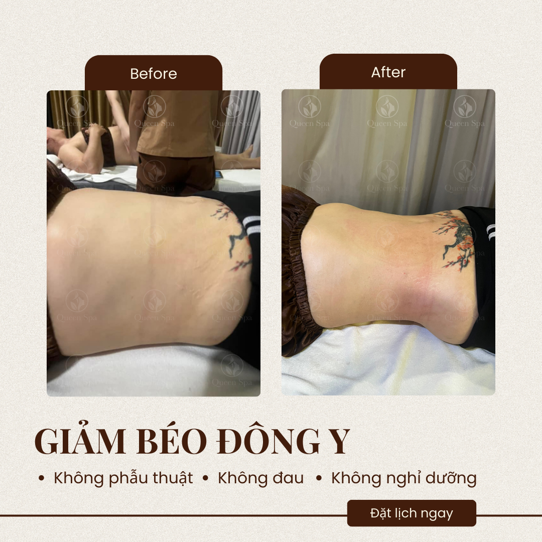Hiệu quả liệu trình massage dưỡng sinh giảm béo tại Queen Spa