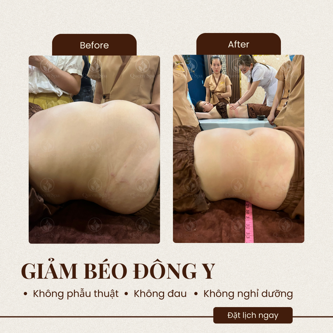 Hiệu quả liệu trình massage dưỡng sinh giảm béo tại Queen Spa