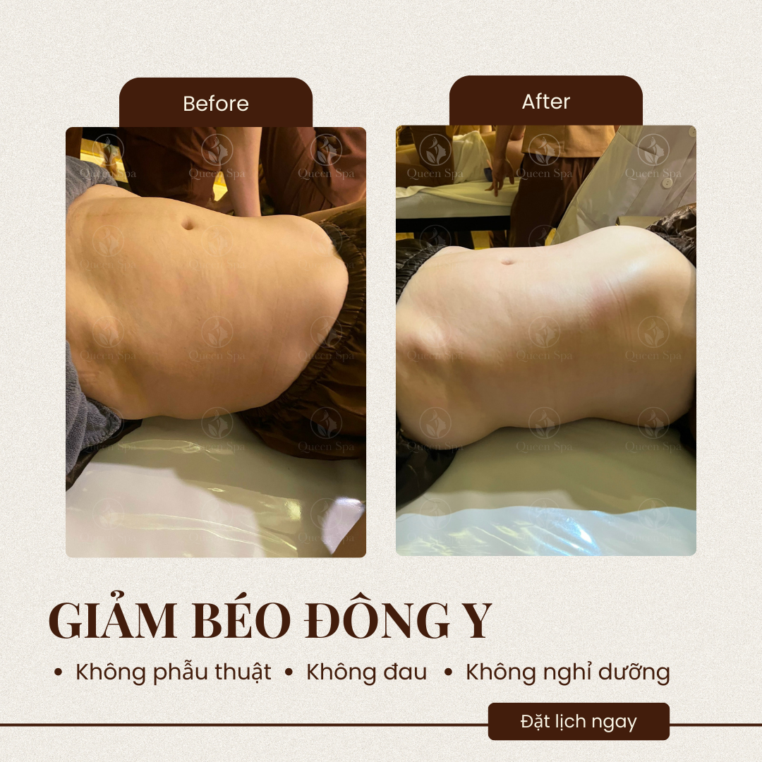 Hiệu quả liệu trình massage dưỡng sinh giảm béo tại Queen Spa