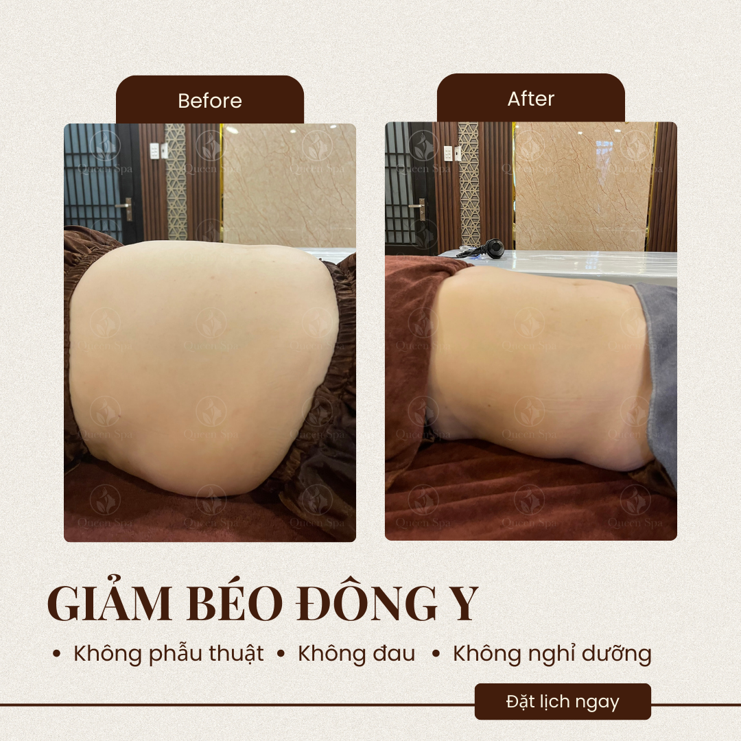 Hiệu quả liệu trình massage dưỡng sinh giảm béo tại Queen Spa