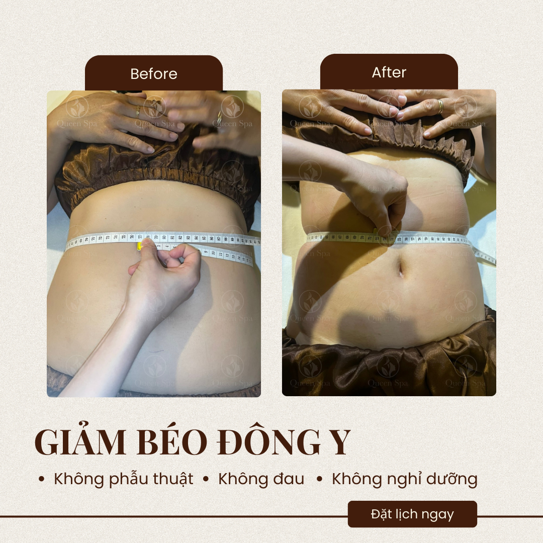 Hiệu quả liệu trình massage dưỡng sinh giảm béo tại Queen Spa