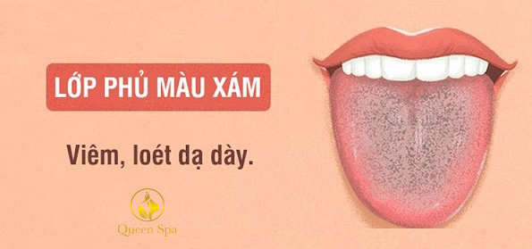 QUEEN SPA